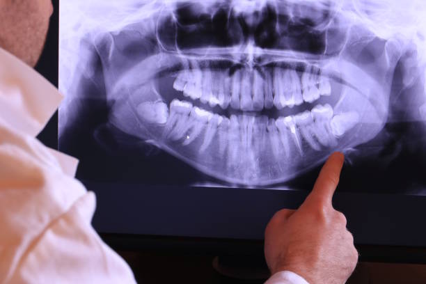 Best Emergency Tooth Extraction in Winchester, KY