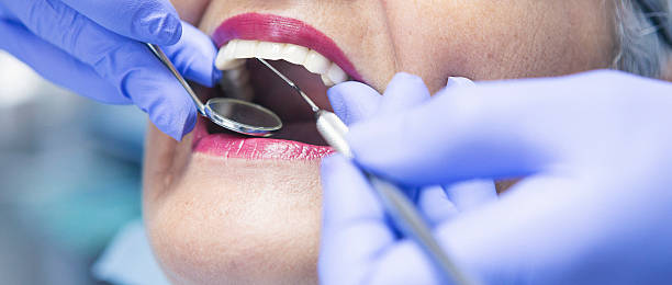 Best Emergency Tooth Extraction in Winchester, KY