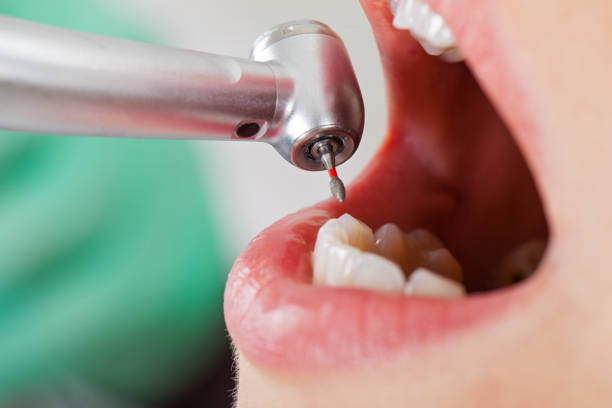 Best Emergency Treatment for Toothache in Winchester, KY